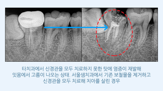 인정받는 이유