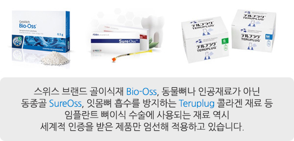 서울샘의 임플란트?