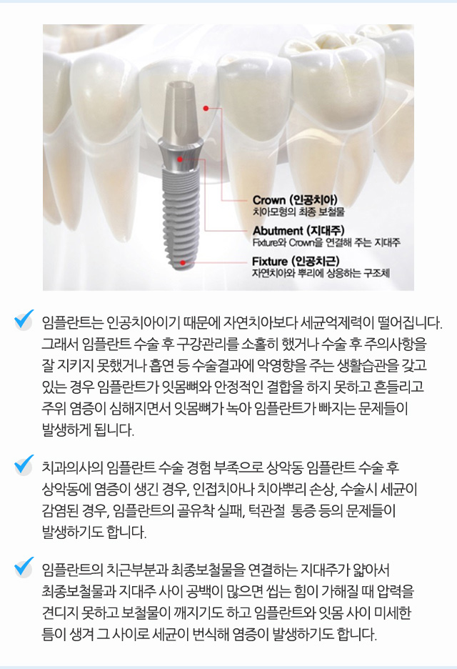 임플란트 재치료