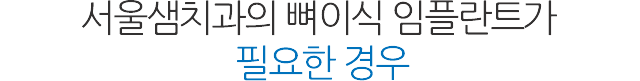 뼈이식 임플란트