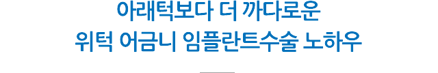 상악동 임플란트