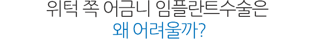 상악동 임플란트