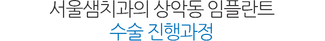 상악동 임플란트