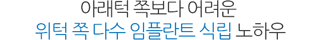 전체 임플란트