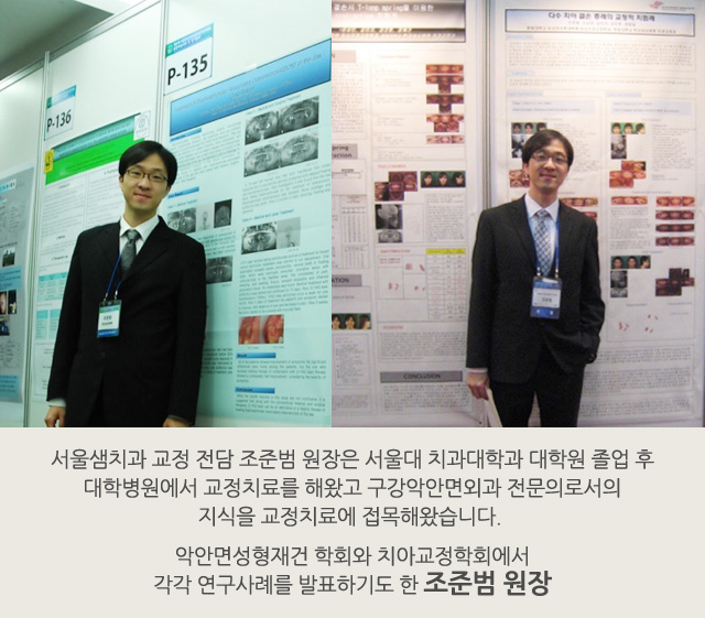 벌어진 치아/개방교합
