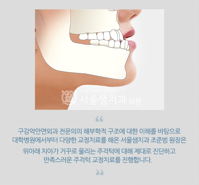 주걱턱/무턱