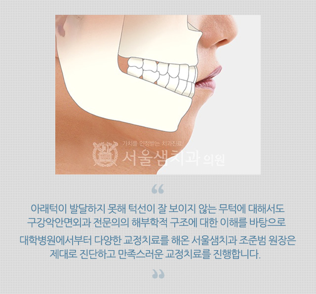 주걱턱/무턱
