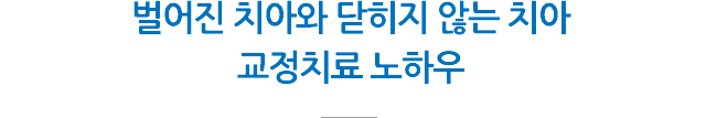 벌어진 치아/개방교합