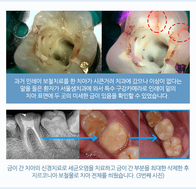 크라운