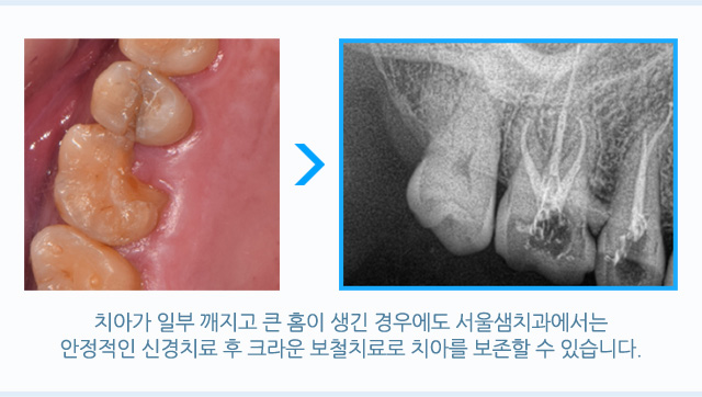 크라운