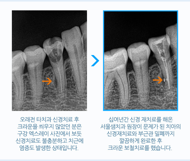 크라운
