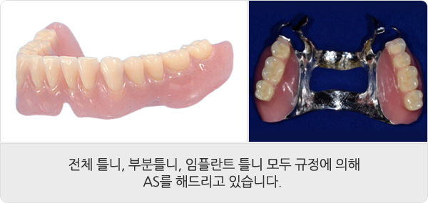 임플란트 틀니, 틀니
