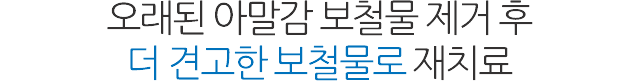 보철 재치료