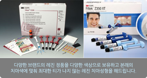 레진 치아성형