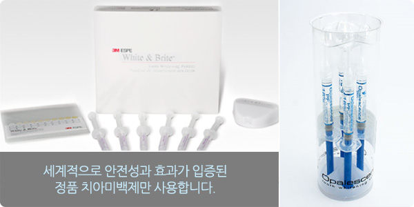 치아미백, 잇몸성형
