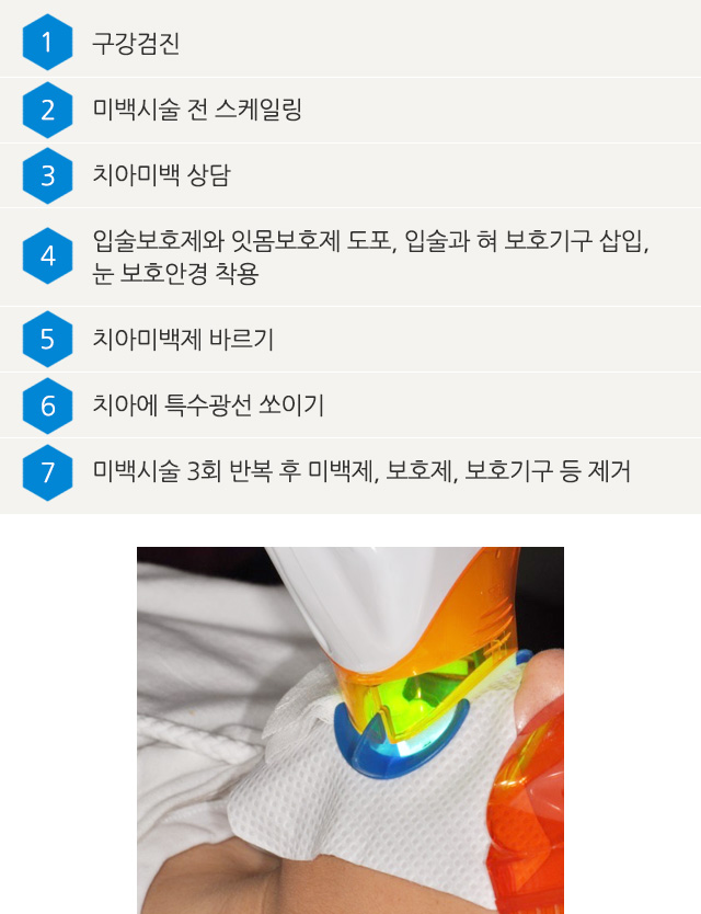 치아미백, 잇몸성형