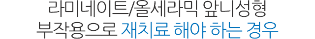 앞니성형/재치료