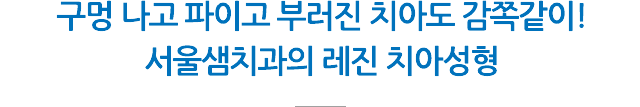 레진 치아성형