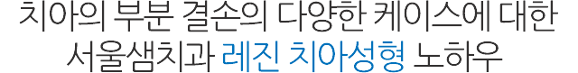 레진 치아성형