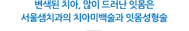 치아미백, 잇몸성형