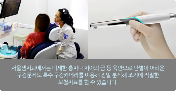 금 간 치아