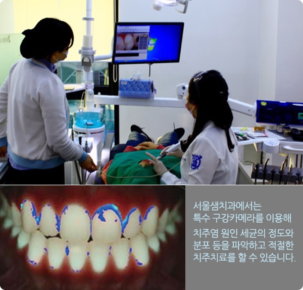 치주치료
