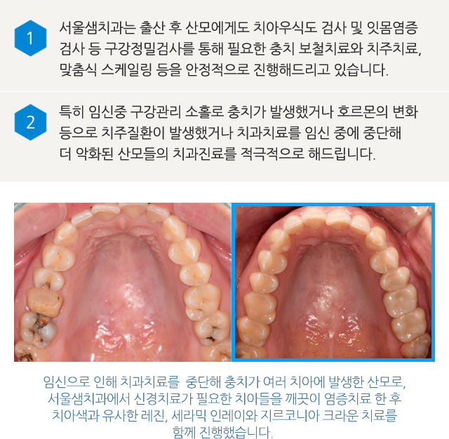 임산부 구강관리