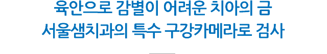 금 간 치아